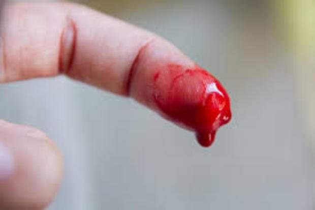 Bleeding Disorders Treatment Market
