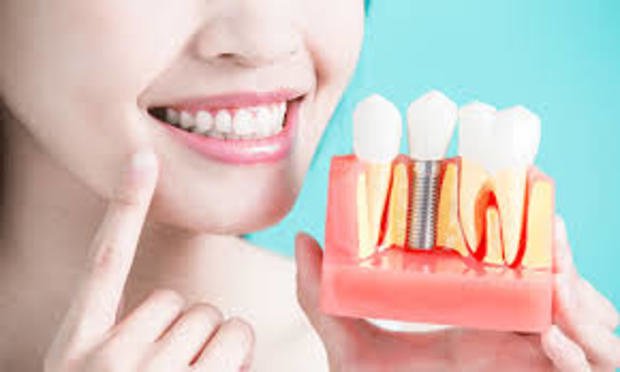 Dental Bone Graft Market