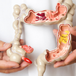 Top Oncologist For Colon Cancer India